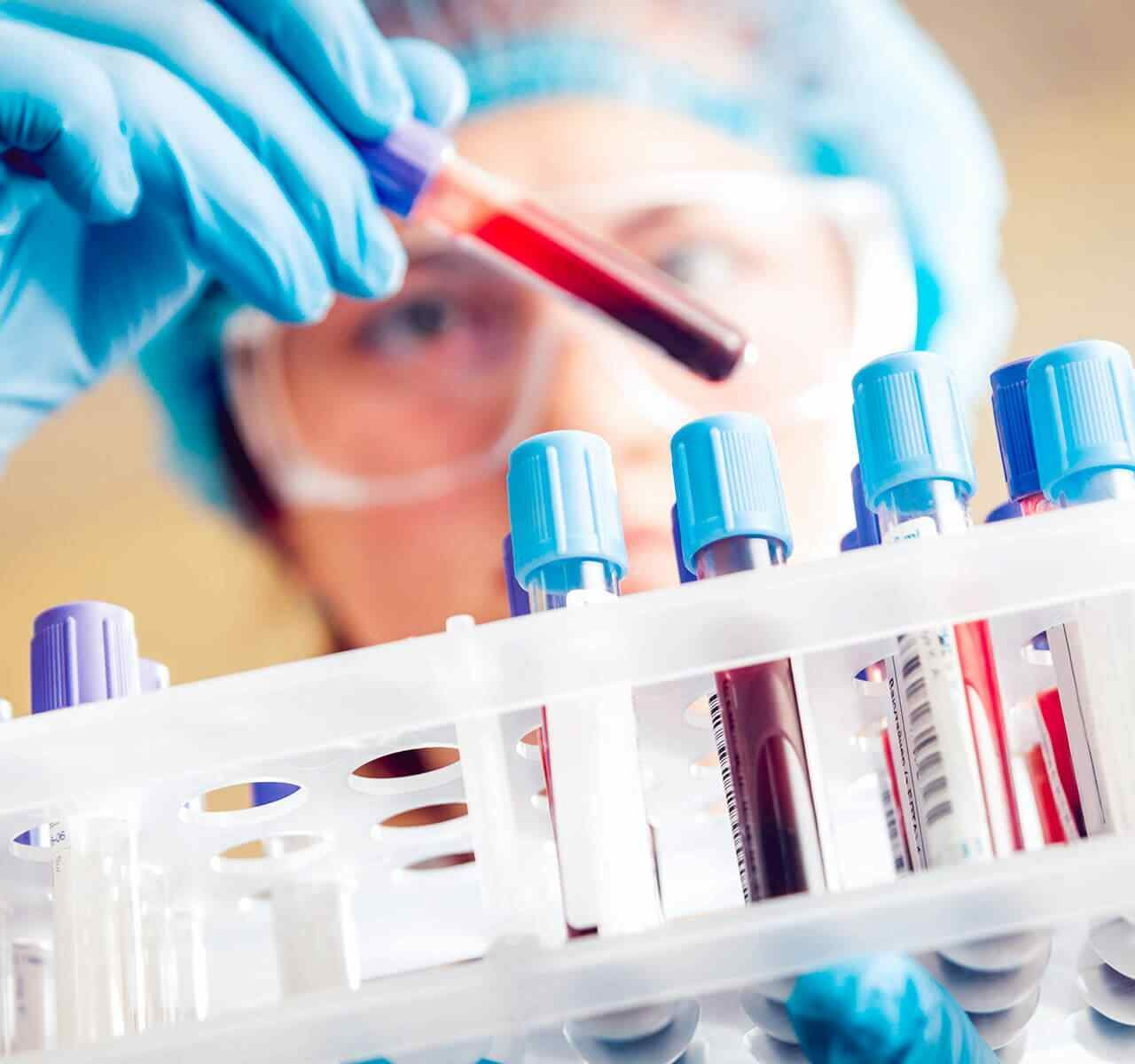 Improved Detection of Acute Lyme Disease